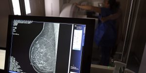 medicos-lancam-guia-para-evitar-recusa-de-mamografia-digital